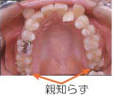 治療前