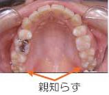 治療後